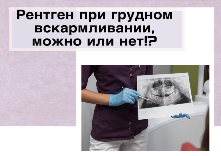 Рентген при грудном вскармливании